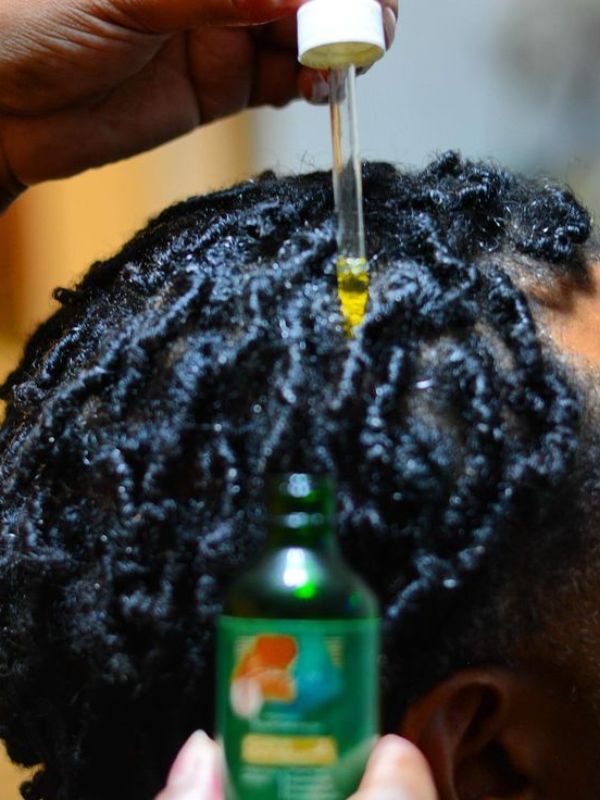 How-to-Get-Rid-of-Dandruff-in-Locs-Naturally