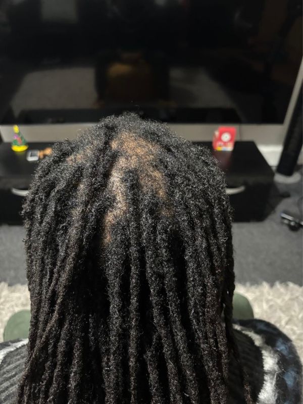 Locs