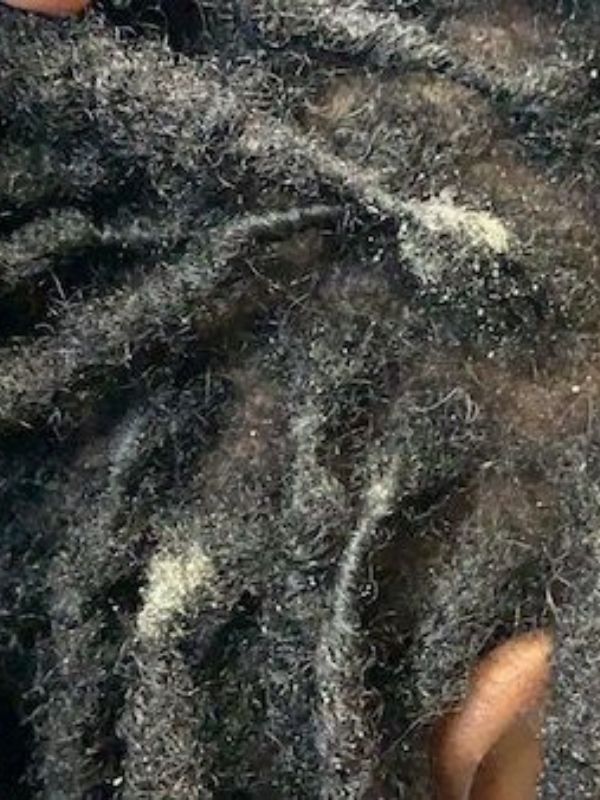 Locs